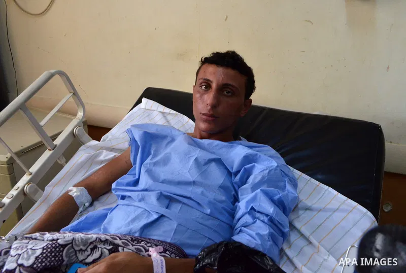 A rescued migrant lies in bed as he receives treatment at Rashid hospital in the port city of Rosetta, north of Cairo, Egypt, September 22, 2016. Egypt's official news agency MENA said the boat was carrying 600 people wh...