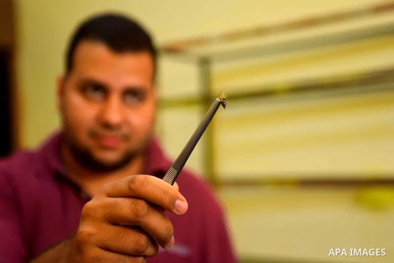 An Egyptian man is treated by the use of a bee sting at a centre in Cairo Out. 01, 2016. Photo by Amr Sayed