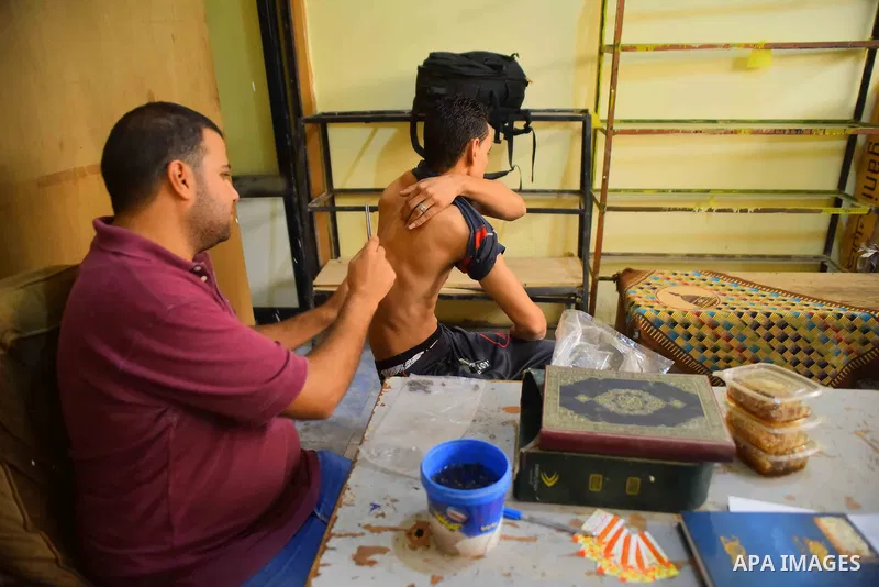An Egyptian man places a bee on a man suffering from back problems so it can sting him at a centre in Cairo Out. 01, 2016. Photo by Amr Sayed
