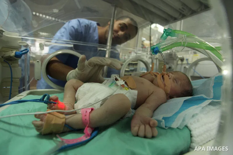 One-day-old Palestinian conjoined twin boys lie in an incubator at the nursery at al-Shifa Hospital in Gaza City on November 23, 2016. Photo by Ashraf Amra