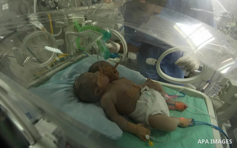 One-day-old Palestinian conjoined twin boys lie in an incubator at the nursery at al-Shifa Hospital in Gaza City on November 23, 2016. Photo by Ashraf Amra