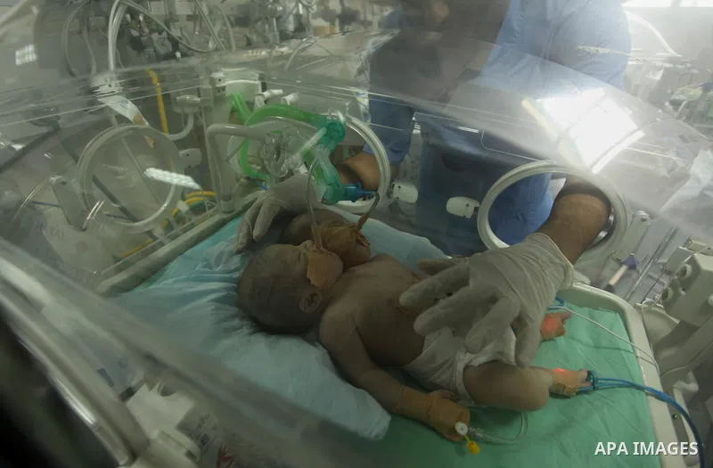 One-day-old Palestinian conjoined twin boys lie in an incubator at the nursery at al-Shifa Hospital in Gaza City on November 23, 2016. Photo by Ashraf Amra