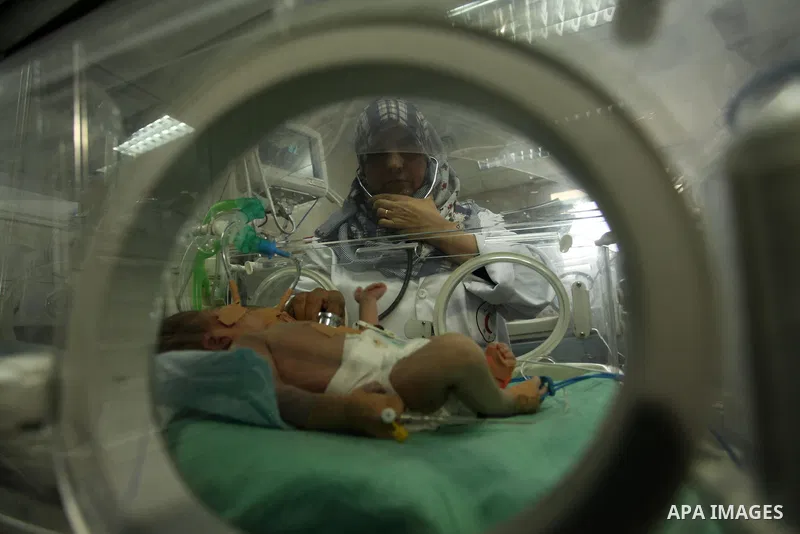 One-day-old Palestinian conjoined twin boys lie in an incubator at the nursery at al-Shifa Hospital in Gaza City on November 23, 2016. Photo by Ashraf Amra
