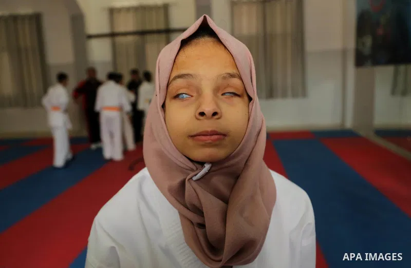 A Palestinian blind girl, Menna Allah al Bitar, takes part in a Karate class at the club Mashtal in Gaza city on February 5, 2017. The training is held twice a week by the club to lift the morale of the children, trainer...