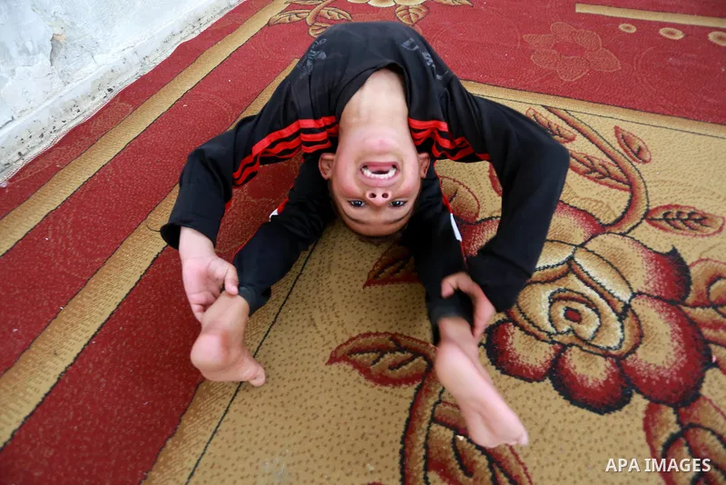 Wael Gharbaoui, a 6-year-old Palestinian boy, demonstrates acrobatics skills at his house in Jabalia refugee camp in the northern Gaza Strip, on March 01, 2017. Photo by Mohammed Asad