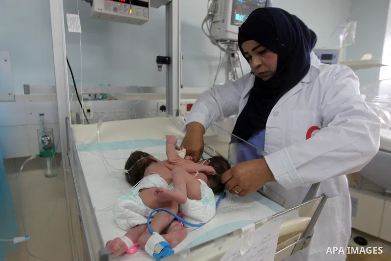 A Palestinian nurse checks on a One-day-old Palestinian conjoined twin boys lie in an incubator at the nursery Hospital in the West Bank city of Hebron, March 16, 2017. Photo by Wisam Hashlamoun