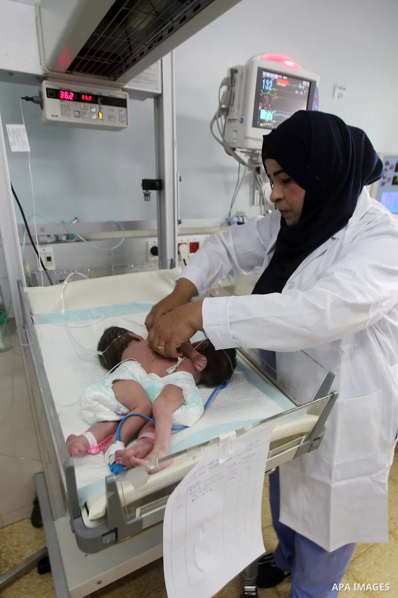 A Palestinian nurse checks on a One-day-old Palestinian conjoined twin boys lie in an incubator at the nursery Hospital in the West Bank city of Hebron, March 16, 2017. Photo by Wisam Hashlamoun