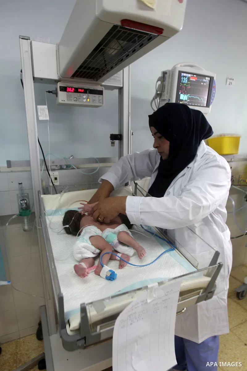 A Palestinian nurse checks on a One-day-old Palestinian conjoined twin boys lie in an incubator at the nursery Hospital in the West Bank city of Hebron, March 16, 2017. Photo by Wisam Hashlamoun