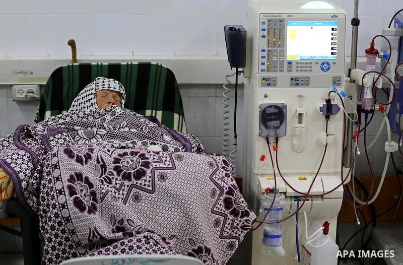 A Palestinian patient woman gets her kidneys washed at the dialysis department in the Al-Shifa hospital during the worsening crisis of power outages in Gaza City on April 29, 2017. Photo by Ashraf Amra