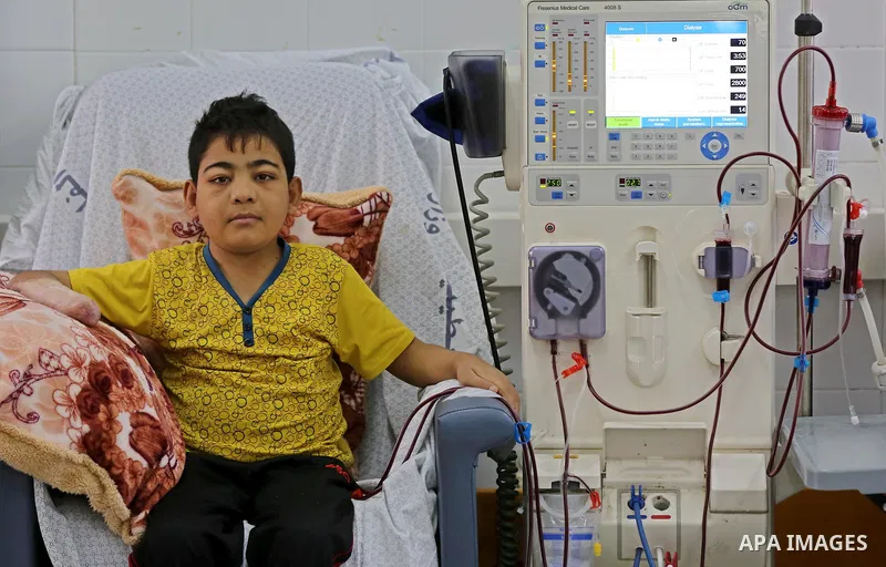 A Palestinian patient boy gets his kidneys washed at the dialysis department in the Al-Shifa hospital during the worsening crisis of power outages in Gaza City on April 29, 2017. Photo by Ashraf Amra