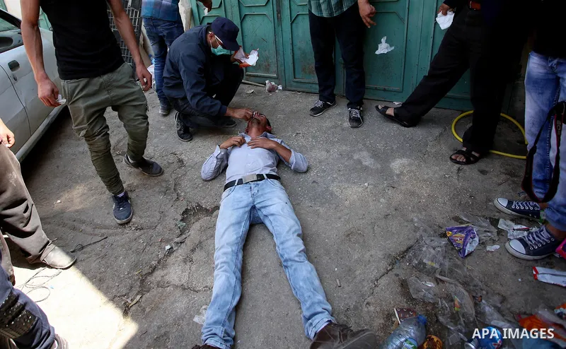 A Palestinian wounded receives treatment during clashes with Israeli security forces at a protest in support of Palestinian prisoners on hunger strike in Israeli jails, in the West Bank village of Beita, near Nablus May...
