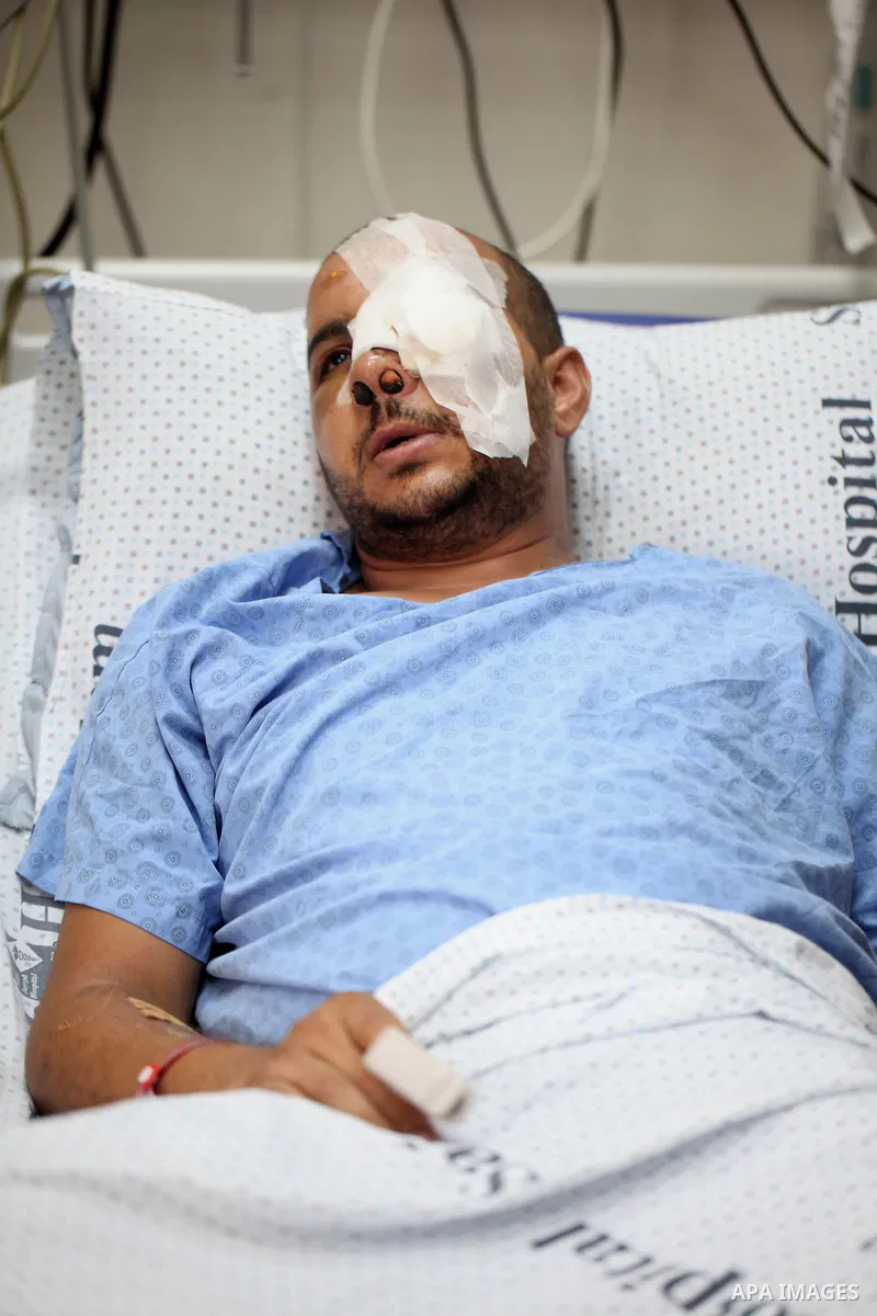 A Palestinian man, Mohammed Abu Tayeh, lies on the bed at a hospital after he was wounded during clashes with Israeli security forces following last Friday prayers in the East Jerusalem neighbourhood of Ras Al Amoud, in...