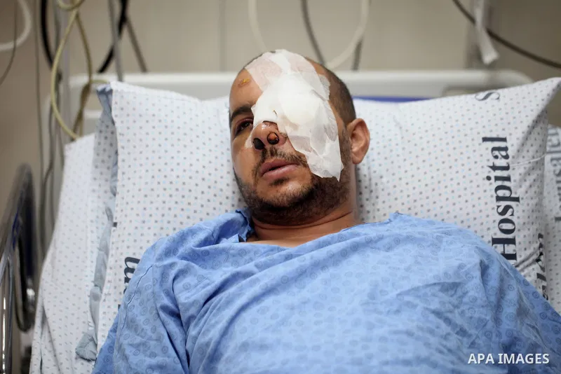A Palestinian man, Mohammed Abu Tayeh, lies on the bed at a hospital after he was wounded during clashes with Israeli security forces following last Friday prayers in the East Jerusalem neighbourhood of Ras Al Amoud, in...
