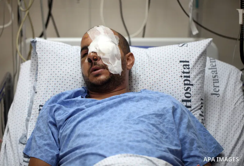 A Palestinian man, Mohammed Abu Tayeh, lies on the bed at a hospital after he was wounded during clashes with Israeli security forces following last Friday prayers in the East Jerusalem neighbourhood of Ras Al Amoud, in...