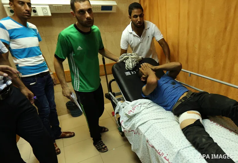 Injured Palestinian protesters, who were wounded during clashes with the Israeli army along the Gaza border, recieves treatment at a hospital in Deir al-Balah in the central Gaza strip on July 28, 2017. Photo by Ashraf A...