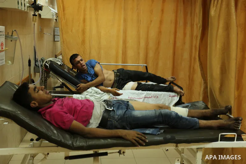Injured Palestinian protesters, who were wounded during clashes with the Israeli army along the Gaza border, recieves treatment at a hospital in Deir al-Balah in the central Gaza strip on July 28, 2017. Photo by Ashraf A...