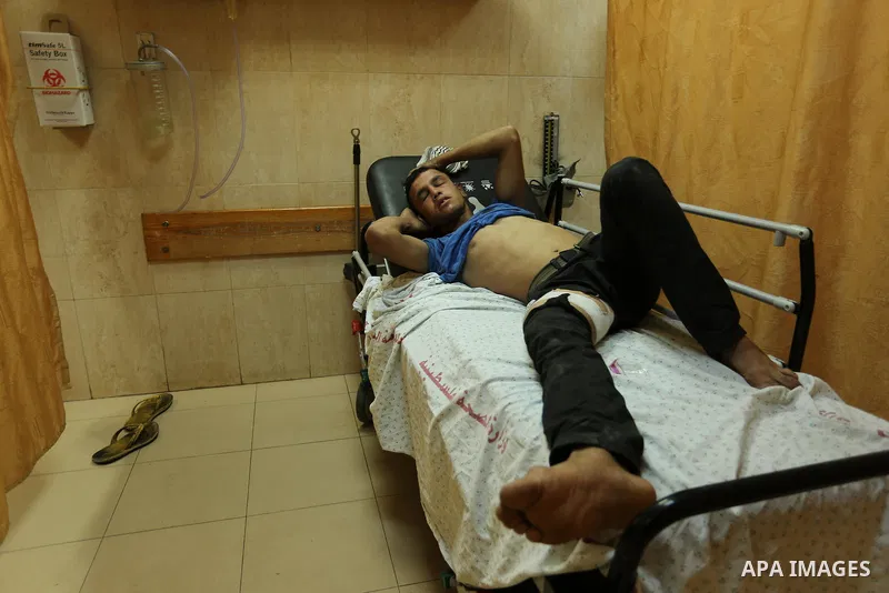 Injured Palestinian protesters, who were wounded during clashes with the Israeli army along the Gaza border, recieves treatment at a hospital in Deir al-Balah in the central Gaza strip on July 28, 2017. Photo by Ashraf A...