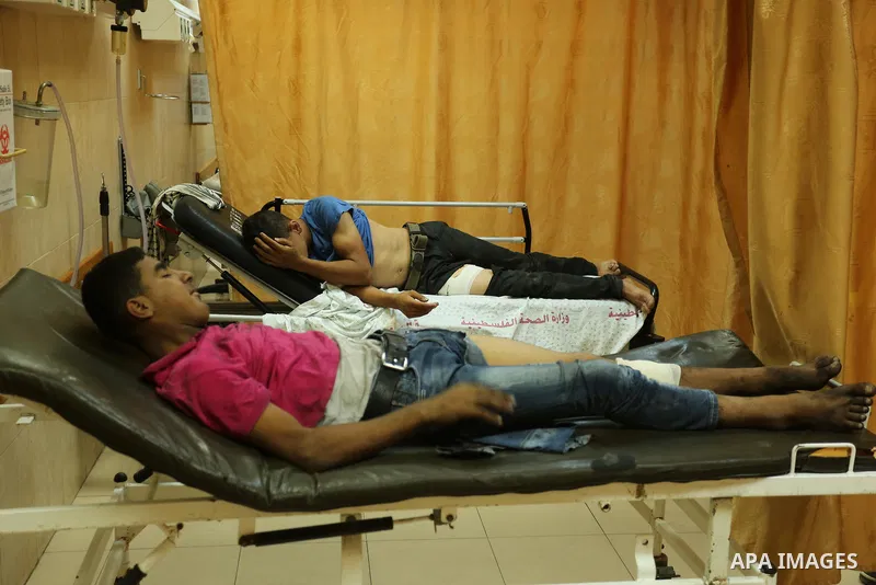 Injured Palestinian protesters, who were wounded during clashes with the Israeli army along the Gaza border, recieves treatment at a hospital in Deir al-Balah in the central Gaza strip on July 28, 2017. Photo by Ashraf A...