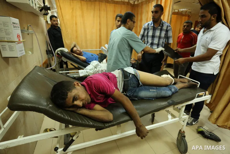 Injured Palestinian protesters, who were wounded during clashes with the Israeli army along the Gaza border, recieves treatment at a hospital in Deir al-Balah in the central Gaza strip on July 28, 2017. Photo by Ashraf A...