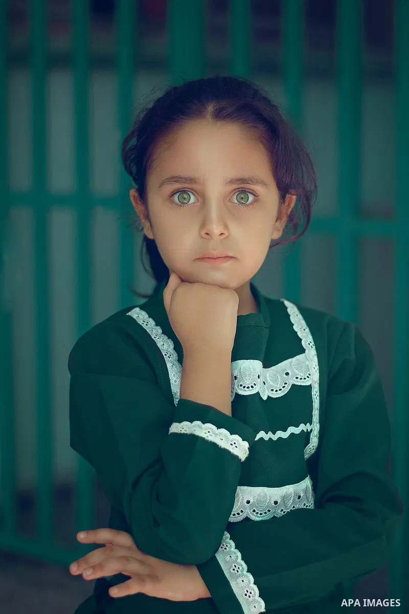 A green eyes with surprise look. Photo by Sanad Ltefa