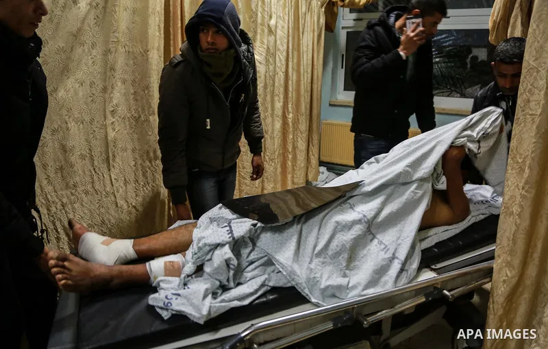 A wounded palestinian mis helped at Rafah hospital in the southern Gaza Strip, on February 17, 2018. Two Palestinians were injured in Rafah during Israeli military raids. Israeli jets struck the Gaza Strip after four sol...
