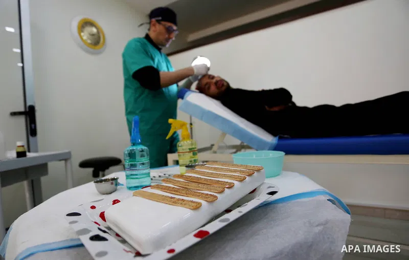 A Palestinian doctor Ahmed al-Moghrabi operates on a patient who undergo to Hair transplant surgery at his clinic, in Gaza city on February 28, 2018. Al-Moghrabi opened his clinic last year which is the first of its kind...