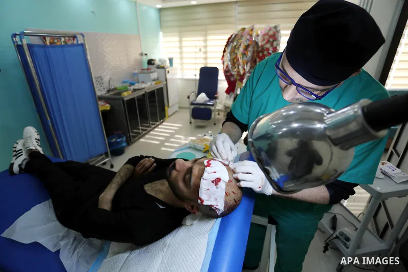 A Palestinian doctor Ahmed al-Moghrabi operates on a patient who undergo to Hair transplant surgery at his clinic, in Gaza city on February 28, 2018. Al-Moghrabi opened his clinic last year which is the first of its kind...