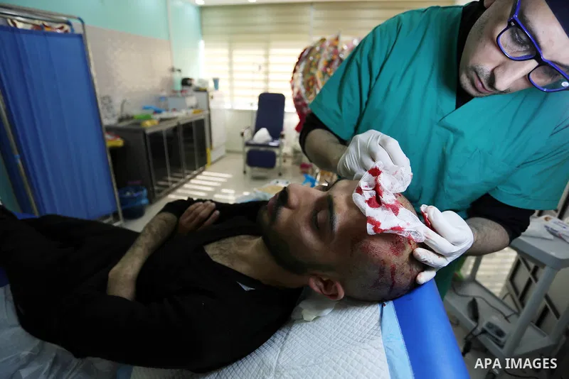 A Palestinian doctor Ahmed al-Moghrabi operates on a patient who undergo to Hair transplant surgery at his clinic, in Gaza city on February 28, 2018. Al-Moghrabi opened his clinic last year which is the first of its kind...