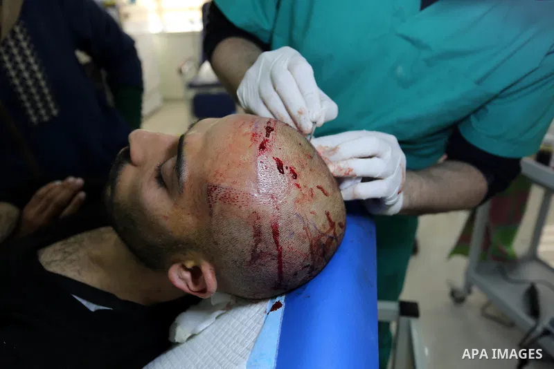 A Palestinian doctor Ahmed al-Moghrabi operates on a patient who undergo to Hair transplant surgery at his clinic, in Gaza city on February 28, 2018. Al-Moghrabi opened his clinic last year which is the first of its kind...