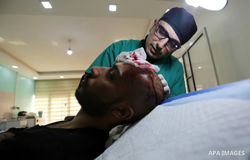 A Palestinian doctor Ahmed al-Moghrabi operates on a patient who undergo to Hair transplant surgery at his clinic, in Gaza city on February 28, 2018. Al-Moghrabi opened his clinic last year which is the first of its kind...
