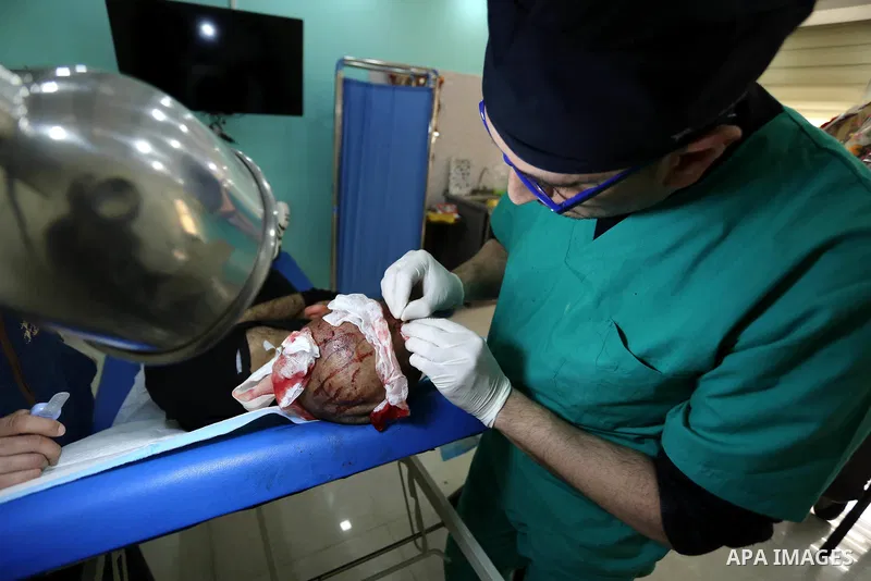 A Palestinian doctor Ahmed al-Moghrabi operates on a patient who undergo to Hair transplant surgery at his clinic, in Gaza city on February 28, 2018. Al-Moghrabi opened his clinic last year which is the first of its kind...