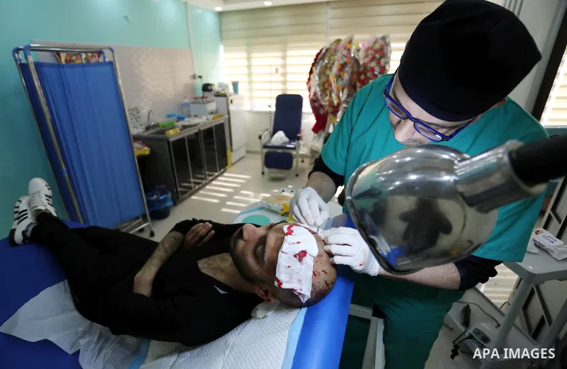 A Palestinian doctor Ahmed al-Moghrabi operates on a patient who undergo to Hair transplant surgery at his clinic, in Gaza city on February 28, 2018. Al-Moghrabi opened his clinic last year which is the first of its kind...