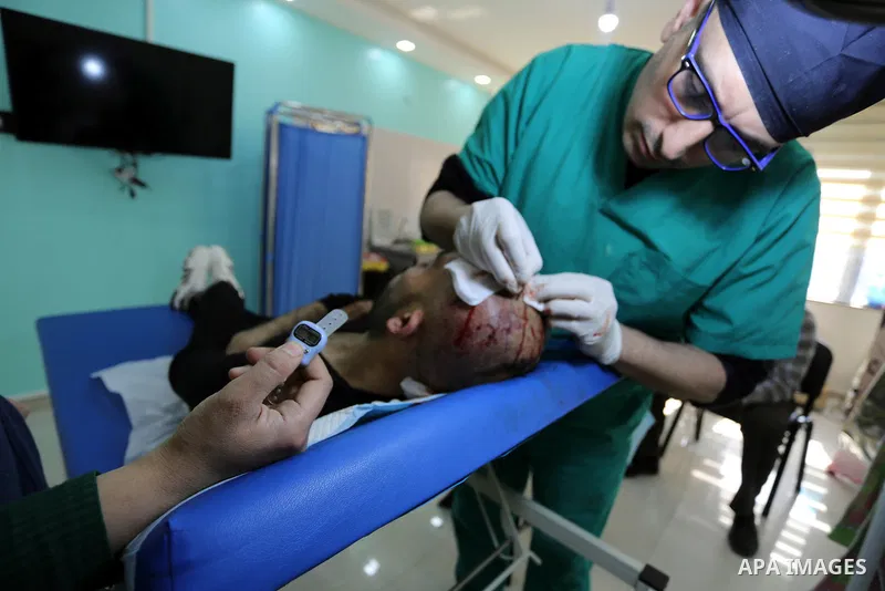 A Palestinian doctor Ahmed al-Moghrabi operates on a patient who undergo to Hair transplant surgery at his clinic, in Gaza city on February 28, 2018. Al-Moghrabi opened his clinic last year which is the first of its kind...