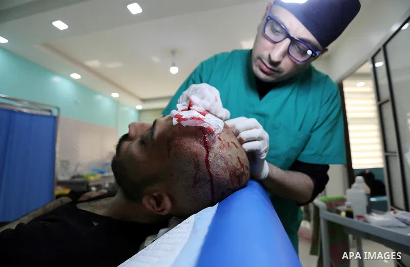 A Palestinian doctor Ahmed al-Moghrabi operates on a patient who undergo to Hair transplant surgery at his clinic, in Gaza city on February 28, 2018. Al-Moghrabi opened his clinic last year which is the first of its kind...