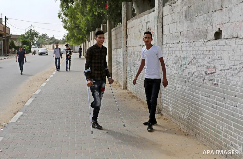 Palestinian Mohammed Musabeh, 17, a High school student, who amputated his leg after he was shot by Israeli troops during clashes in tents protest demanding the right to return to their homeland, at the Israel-Gaza borde...