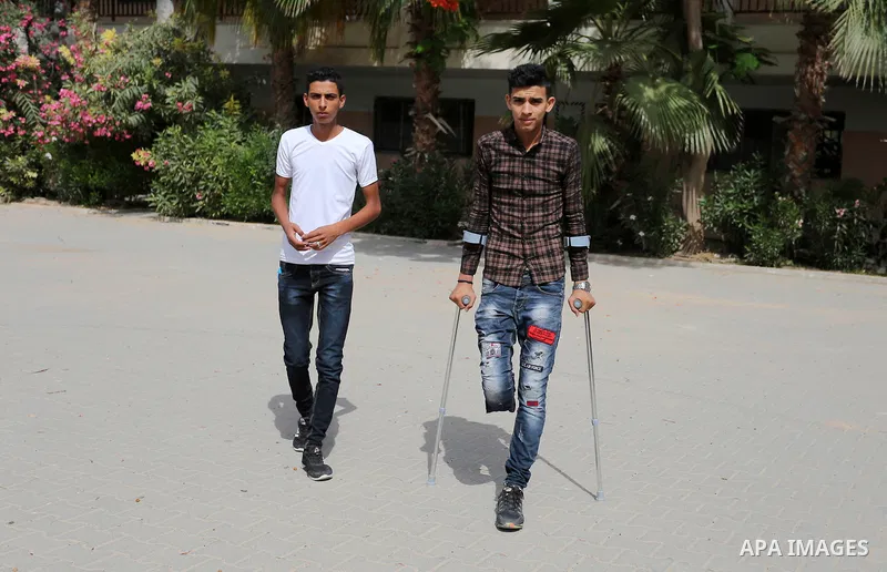 Palestinian Mohammed Musabeh, 17, a High school student, who amputated his leg after he was shot by Israeli troops during clashes in tents protest demanding the right to return to their homeland, at the Israel-Gaza borde...