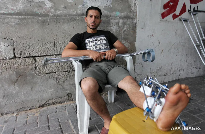 Palestinians who were injured during clashes with Israeli troops in tents protest where Palestinians demand their rights to return to their homeland at Israel-Gaza border, wait to receive treatment at Doctors Without Bor...