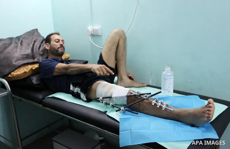 A Palestinian wounded who was injured during clashes with Israeli troops in tents protest where Palestinians demand their rights to return to their homeland at Israel-Gaza border, receives treatment at Doctors Without Bo...