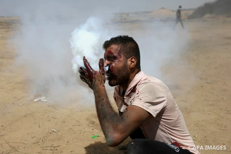 A wounded Palestinian protester reacts as he is hit in the face with a tear gas canister fired by Israeli troops during a protest marking al-Quds Day, (Jerusalem Day), at the Israel-Gaza border in Khan Younis in the sout...