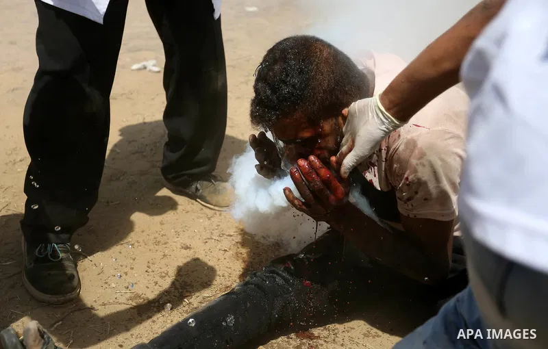 A wounded Palestinian protester reacts as he is hit in the face with a tear gas canister fired by Israeli troops during a protest marking al-Quds Day, (Jerusalem Day), at the Israel-Gaza border in Khan Younis in the sout...