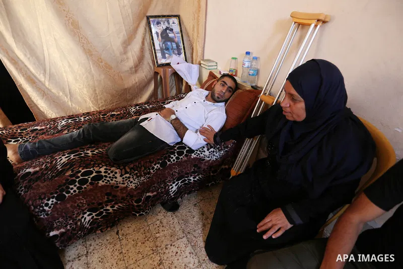 Palestinian disabled Mohammed Al Akhras, 32, who lost his leg by Israeli troops during clashes at Gaza-Israel border lies on his bed at his home in Rafah in the southern Gaza Strip on June 14, 2018. Since 30 March Israel...