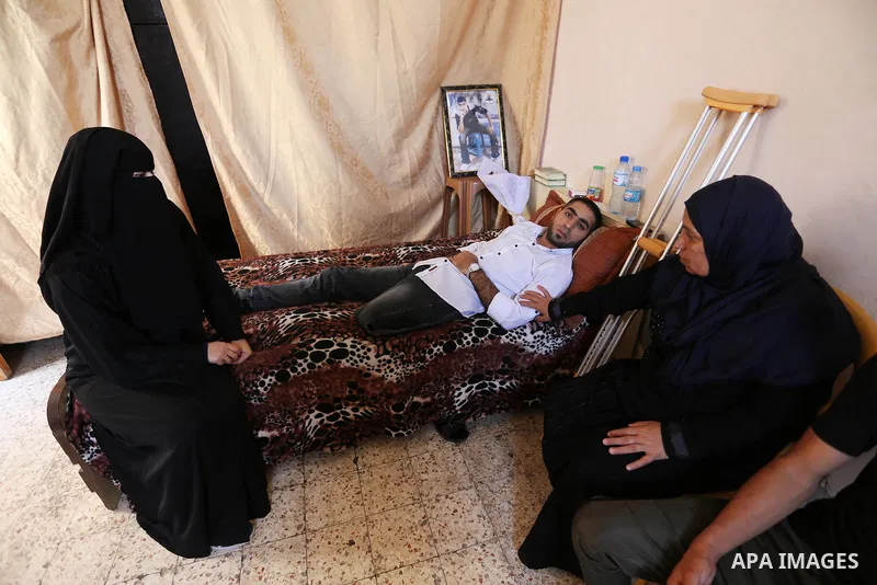 Palestinian disabled Mohammed Al Akhras, 32, who lost his leg by Israeli troops during clashes at Gaza-Israel border lies on his bed at his home in Rafah in the southern Gaza Strip on June 14, 2018. Since 30 March Israel...