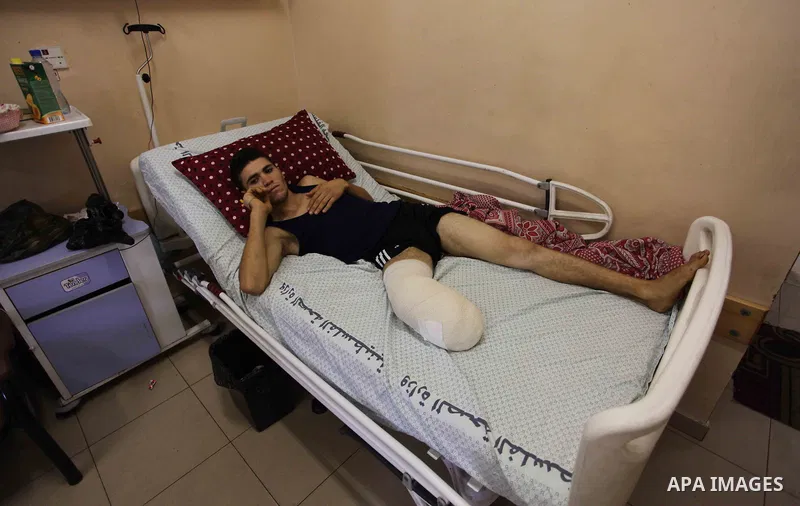 A Palestinian man who was wounded by Israeli troops during clashes at the Israel-Gaza border, lies on a bed to receive treatment on the second day of Eid al-Fitr holiday at al-shifa hospital in Gaza city on June 16, 2018...