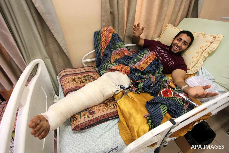 A Palestinian man who was wounded by Israeli troops during clashes at the Israel-Gaza border, lies on a bed to receive treatment on the second day of Eid al-Fitr holiday at al-shifa hospital in Gaza city on June 16, 2018...