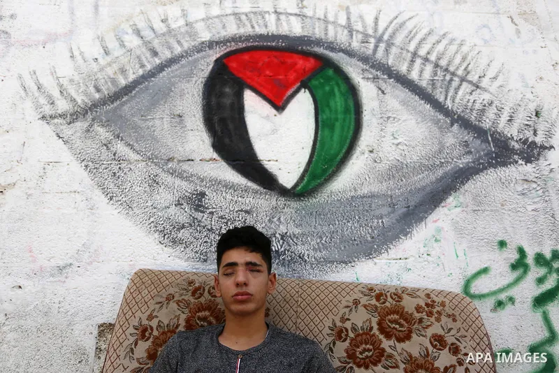 A Palestinian blind Saleh Ashour, 16, who lost his sight by Israeli troops during clashes at Gaza-Israel border, sits on a sofa at his family house in Nusseirat refugee camp in the center of Gaza Strip on July 1, 2018. P...