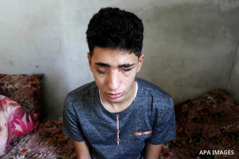 A Palestinian blind Saleh Ashour, 16, who lost his sight by Israeli troops during clashes at Gaza-Israel border, sits on a bed at his family house in Nusseirat refugee camp in the center of Gaza Strip on July 1, 2018. Ph...