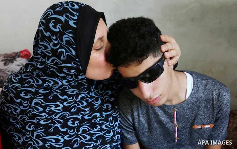 The mother of Palestinian blind Saleh Ashour, 16, who lost his sight by Israeli troops during clashes at Gaza-Israel border, kisses his face at their house in Nusseirat refugee camp in the center of Gaza Strip on July 1,...