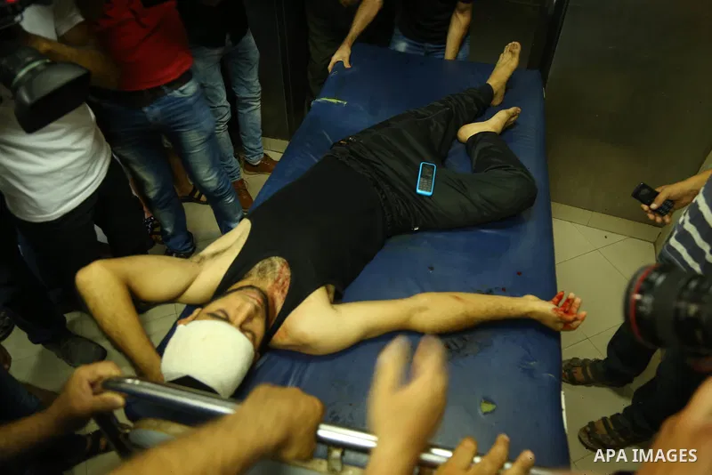 Medics treat a Palestinian man who was injured during an Israeli air strike on Gaza city, at al-Shifa hospital, 14 July 2018. At least two Palestinians were killed after an Israeli air strike on Gaza City. The building i...