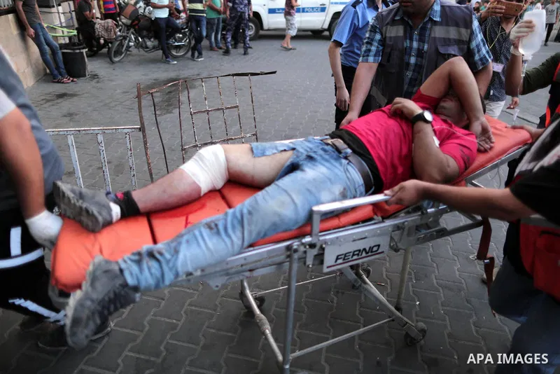 A Palestinian man who was wounded by Israeli troops during clashes at the Israel-Gaza border, in a tent city protest where Palestinians demand the right to return to their homeland, receives treatment at al-Shifa hospita...