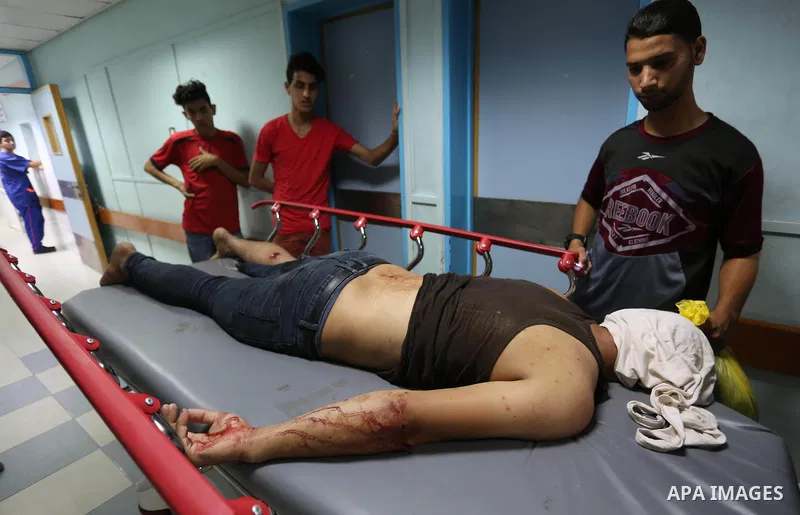 A Palestinian man who was wounded in an Israeli air strike, receives treatment at al-Shifa hospital in Gaza city on July 24, 2018. Photo by Ashraf Amra